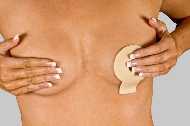 NewGel+  Lollypop for Breast Scars Beige - NG-124