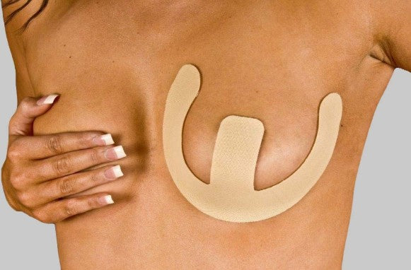NewGel+  Anchors for Breast Scars Beige - NG-126