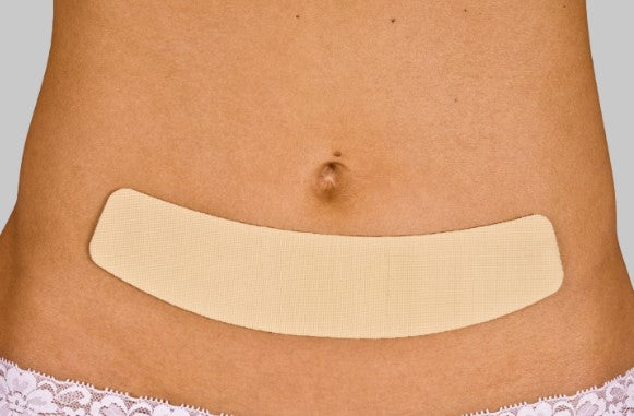 NewGel+ shaped strips for scars 20cm C Section/Abdominoplasty  Beige NG-160
