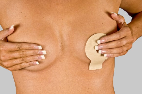 NewGel+  Lollypop for Breast Scars Beige - NG-124